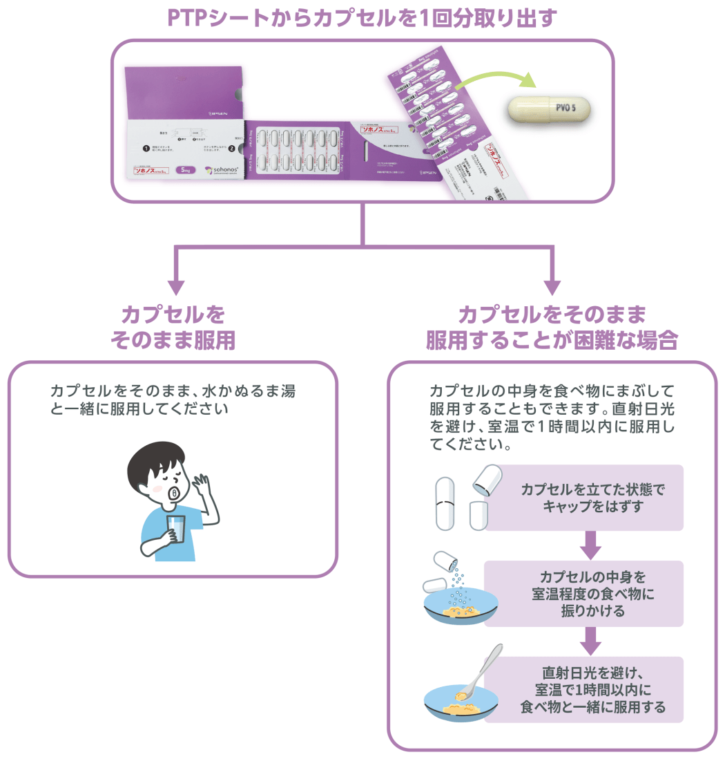 ソホノス®服用方法のフローチャート図。PTPシートから1回分を取り出した後、そのまま水等で服用する場合と、困難な場合にカプセルを開けて中身を室温程度の食べ物にまぶして1時間以内に服用する場合の2つの手順に分岐して説明している。
